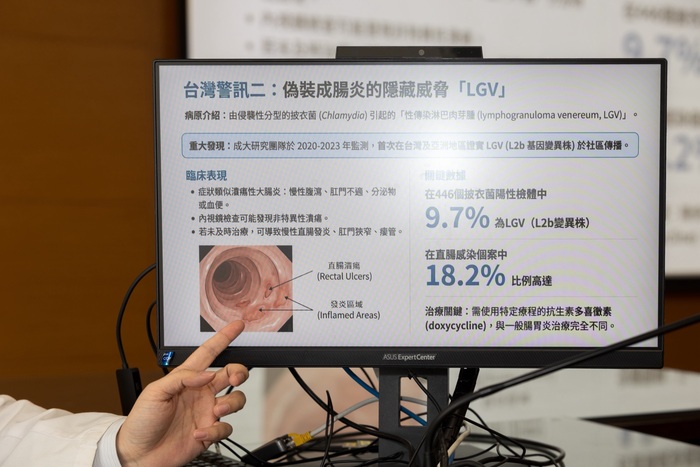 蔡進相醫師於記者會分享【性行為也可能傳染腸道病原】圖片