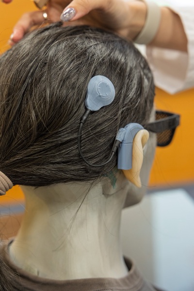 人工耳蝸能將聲音轉換為電訊號，直接刺激聽神經，是重度聽損者的介入選擇圖片