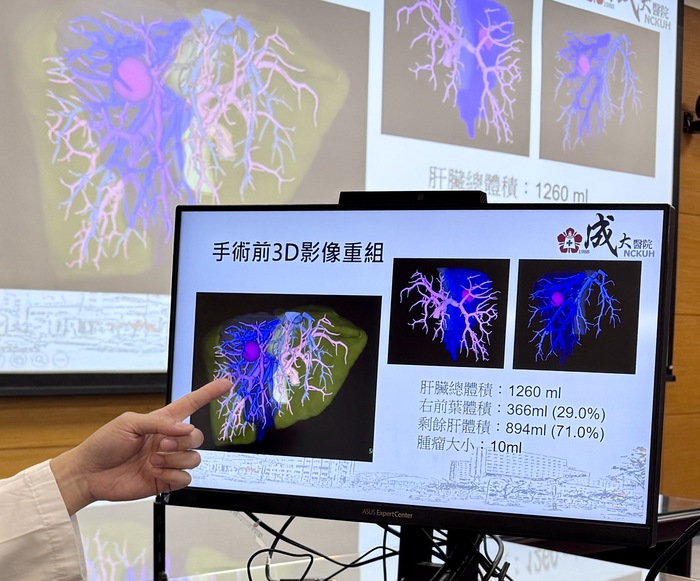 楊宗翰醫師於記者會分享【精準肝臟手術】議題圖片
