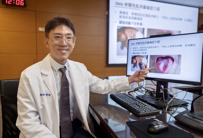 吳博銘醫師於記者會分享【脊髓性肌肉萎縮症(SMA)】治療新里程圖片