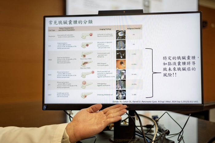 王堯生醫師於記者會說明「胰臟囊腫」醫療衛教議題圖片