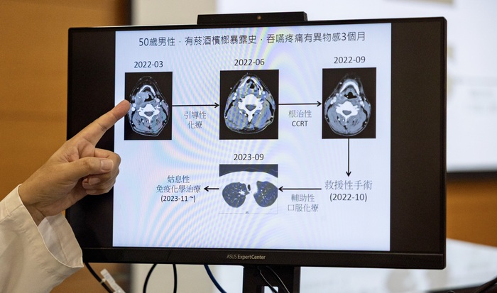 吳尚殷醫師於記者會分享【晚期下咽癌治療策略的選擇】圖片