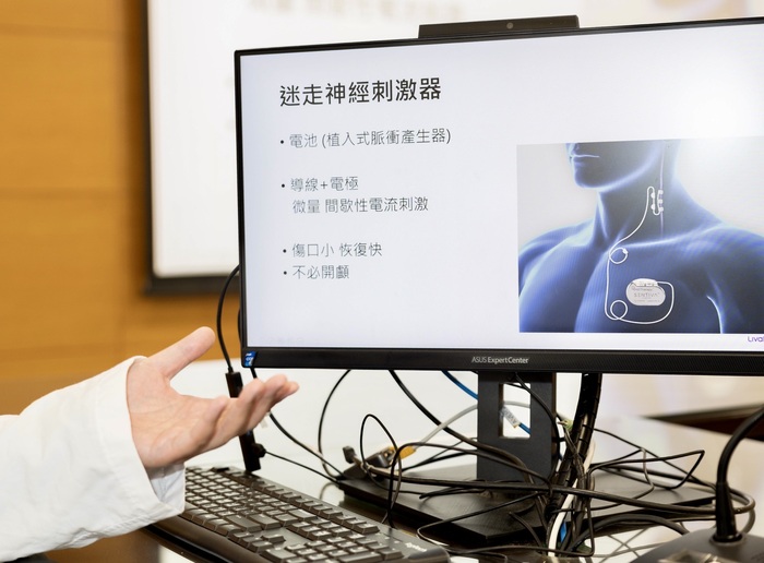 李柏萱醫師於記者會分享【迷走神經刺激術】圖片